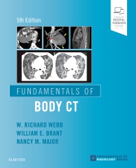 Download Fundamentals Of Body Ct Review